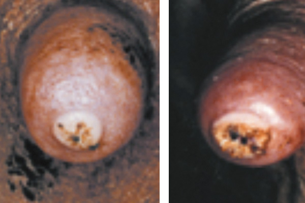 teat scoring hyperkeratosis